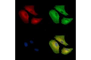 ABIN7096925 and ABIN7100991 staining  cells by IF/ICC. (CLN8 抗体)