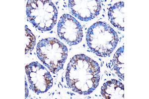 Immunohistochemistry (IHC) image for anti-Cytochrome P450, Family 11, Subfamily A, Polypeptide 1 (CYP11A1) (AA 40-320) antibody (ABIN1512804)