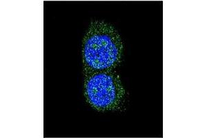 Immunofluorescence (IF) image for anti-Sequestosome 1 (SQSTM1) (AA 324-353), (C-Term) antibody (ABIN1449619)