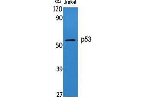 Western Blot (WB) analysis of specific cells using p53 Polyclonal Antibody. (p53 抗体  (Tyr191))