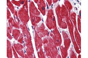 IHC Information: Paraffin embedded heart tissue, tested with an antibody dilution of 5 ug/ml. (STAU1/Staufen 抗体  (N-Term))