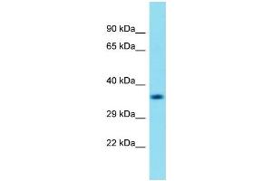 Western Blotting (WB) image for anti-Chromosome 18 Open Reading Frame 8 (C18orf8) (N-Term) antibody (ABIN2156479) (C18orf8 抗体  (N-Term))