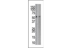 The anti-RUVBL21 Pab (ABIN388628 and ABIN2837871) is used in Western blot to detect RUVBL2 in mouse kidney (left) and SK-Br-3 (right) tissue/cell line lysates. (Reptin,TIP49B,RUVB2 (AA 400-430), (C-Term) 抗体)