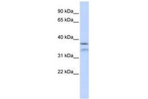 Image no. 1 for anti-Hydrolethalus Syndrome 1 (HYLS1) (AA 216-265) antibody (ABIN6743836) (HYLS1 抗体  (AA 216-265))