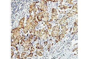 IHC analysis of GLI2 using anti-GLI2 antibody (ABIN6719569). (GLI2 抗体  (AA 721-1457))