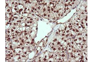 Image no. 4 for anti-Tripartite Motif Containing 38 (TRIM38) (AA 1-265) antibody (ABIN1490681)