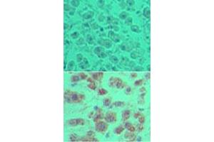 Image no. 1 for anti-OTU Domain Containing 5 (OTUD5) (AA 550-600) antibody (ABIN960300) (OTUD5 抗体  (AA 550-600))