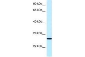 Image no. 1 for anti-Nudix (Nucleoside Diphosphate Linked Moiety X)-Type Motif 16 (NUDT16) (AA 45-94) antibody (ABIN6748090) (NUDT16 抗体  (AA 45-94))