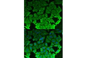 Immunofluorescence (IF) image for anti-Eukaryotic Elongation Factor-2 Kinase (EEF2K) antibody (ABIN1876592)