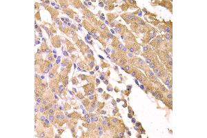 Immunohistochemistry of paraffin-embedded human stomach using SUFU antibody at dilution of 1:100 (x400 lens). (SUFUH 抗体)
