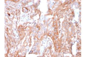 Immunohistochemistry (IHC) image for anti-5'-Nucleotidase, Ecto (CD73) (NT5E) antibody (ABIN6940227)