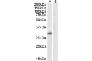 Image no. 1 for anti-E3 Ubiquitin-Protein Ligase SIAH1 (SIAH1) (N-Term) antibody (ABIN374155) (SIAH1 抗体  (N-Term))