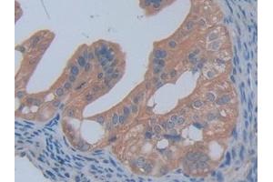 Detection of PFKP in Mouse Ovary Tissue using Polyclonal Antibody to Phosphofructokinase, Platelet (PFKP) (PFKP 抗体  (AA 247-473))
