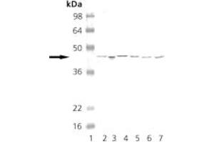 Western blot analysis of PKA: Lane 1: MW marker, Lane 2: CHO-K1, Lane 3: Mouse Brain, Lane 4: Rat Brain, Lane 5: HeLa, Lane 6: 3T3, Lane 7: PC-12. (PKA 抗体)