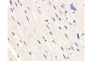 Immunohistochemistry analysis of paraffin-embedded rat heart using HES2 Polyclonal Antibody at dilution of 1:200. (HES2 抗体)