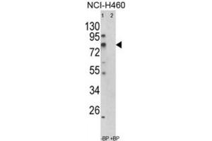 Western Blotting (WB) image for anti-Acyl-CoA Synthetase Short-Chain Family Member 3 (ACSS3) antibody (ABIN3003813) (ACSS3 抗体)