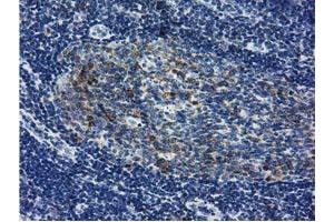 Immunohistochemical staining of paraffin-embedded Human lymph node tissue using anti-LIN7B mouse monoclonal antibody. (LIN7B 抗体)