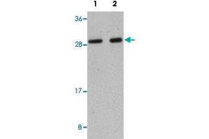 Western blot analysis of human liver tissue with LYRM1 polyclonal antibody  at (Lane 1) 1 and (Lane 2) 2 ug/mL dilution. (LYRM1 抗体  (Internal Region))
