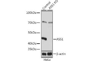 Western blot analysis of extracts from normal (control) and  Rabbit pAb knockout (KO) HeLa cells, using  Rabbit pAb antibody (ABIN7265667) at 1:3000 dilution. (ASS1 抗体  (AA 1-412))
