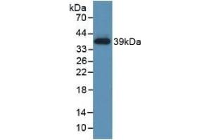 Detection of Recombinant TBG, Human using Polyclonal Antibody to Thyroxine Binding Globulin (TBG) (SERPINA7 抗体  (AA 128-415))