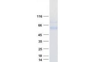 Western Blotting (WB) image for Sperm Adhesion Molecule 1 (PH-20 Hyaluronidase, Zona Pellucida Binding) (SPAM1) (Transcript Variant 1) protein (Myc-DYKDDDDK Tag) (ABIN2732494)