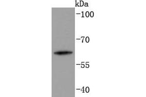 Human skin lysates probed with Cytokeratin 2e (2F7) Monoclonal Antibody  at 1:1000 overnight at 4˚C. (Keratin 2 抗体)