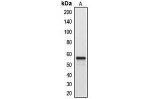 Western blot analysis of Cytochrome P450 2A7 expression in A549 (A) whole cell lysates. (CYP2A7 抗体  (C-Term))