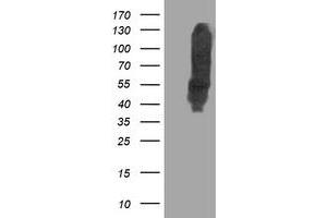 Western Blotting (WB) image for anti-Dihydrolipoamide Dehydrogenase (DLD) antibody (ABIN1497847) (DLD 抗体)