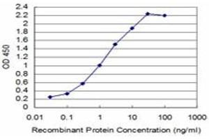 Detection limit for recombinant GST tagged T is approximately 0. (T Brachyury Protein (AA 222-320) 抗体)