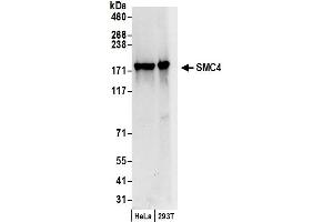 Western Blotting (WB) image for anti-Structural Maintenance of Chromosomes 4 (SMC4) (AA 600-650) antibody (ABIN7449361)