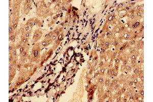 Immunohistochemistry (IHC) image for anti-G0/G1switch 2 (G0S2) (AA 1-103) antibody (ABIN6090663)