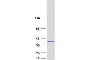 Validation with Western Blot