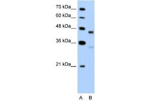 GPR161 antibody used at 5 ug/ml to detect target protein. (GPR161 抗体  (C-Term))