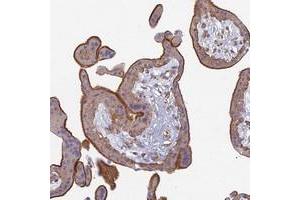 Immunohistochemical staining of human placenta with PROX2 polyclonal antibody  shows strong membranous and cytoplasmic positivity in trophoblastic cells at 1:200-1:500 dilution.