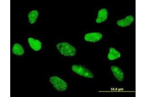 Image no. 2 for anti-Transcription Factor 7 (T-Cell Specific, HMG-Box) (TCF7) (AA 287-385) antibody (ABIN598962) (TCF7 抗体  (AA 287-385))