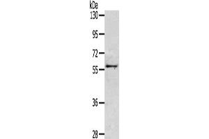 Gel: 6 % SDS-PAGE, Lysate: 40 μg, Lane: Mouse intestines tissue, Primary antibody: ABIN7130495(OLFM3 Antibody) at dilution 1/200, Secondary antibody: Goat anti rabbit IgG at 1/8000 dilution, Exposure time: 2 minutes (Olfactomedin 3 抗体)