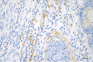 anti-Ribosomal Protein L13 (RPL13) antibody