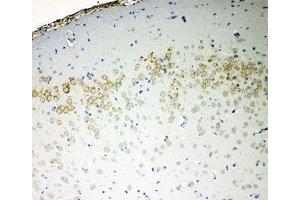 IHC-P: VE-Cadherin antibody testing of rat brain tissue (Cadherin 5 抗体  (AA 766-784))