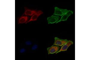 ABIN6264550 and ABIN6277788 staining Hela cells by IF/ICC.