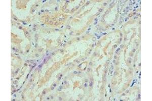 Immunohistochemistry of paraffin-embedded human kidney tissue using ABIN7168895 at dilution of 1:100 (SPTLC1 抗体  (AA 37-310))