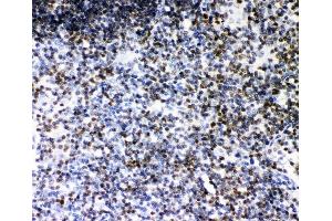 IHC analysis of RUNX1 using anti-RUNX1 antibody (ABIN3043318).