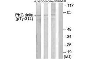 Western blot analysis of extracts from HepG2 cells, COLO205 cells and HuvEc cells, using PKC delta (Phospho-Tyr313) Antibody. (PKC delta 抗体  (pTyr313))