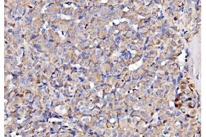 IHC analysis of NDUFAF1 using anti-NDUFAF1 antibody (ABIN7602459).