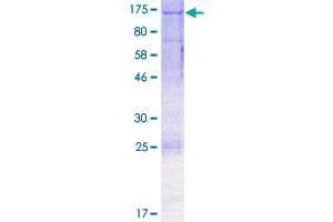 Image no. 1 for EPH Receptor A2 (EPHA2) (AA 1-976) protein (GST tag) (ABIN1352917)