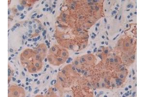 Detection of CTXI in Human Stomach Tissue using Monoclonal Antibody to Cross Linked C-Telopeptide Of Type I Collagen (CTXI) (CTX-I 抗体)
