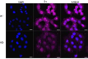 Immunocytochemical staining of HT- cells using Src antibody (ABIN7800054), 1:1,000), Top panel: wild-type (WT), Bottom panal: Src shRNA knockdown (KD). (Recombinant Src 抗体)