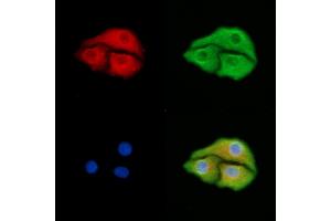 ABIN6259253 and ABIN6275428 staining Hela cells by IF/ICC. (PDXDC1 抗体  (C-Term))