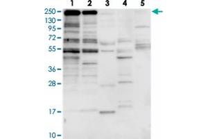 Western blot analysis of Lane 1: RT-4, Lane 2: U-251 MG, Lane 3: Human Plasma, Lane 4: Liver, Lane 5: Tonsil with ZNF646 polyclonal antibody  at 1:250-1:500 dilution. (ZNF646 抗体)