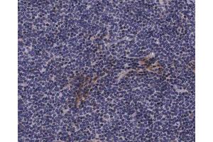 ABIN6267620 at 1/200 staining human lymph nodes tissue sections by IHC-P. (Caldesmon 抗体  (pSer789))