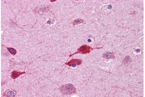 Immunohistochemistry (Formalin-fixed Paraffin-embedded Sections) (IHC (fp)) image for anti-Wingless-Type MMTV Integration Site Family, Member 5A (WNT5A) (AA 180-229) antibody (ABIN574490)
